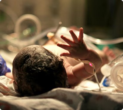 Tips for Parents With Babies in Neonatal Intensive Care